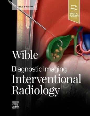 Diagnostic Imaging: Interventional Radiology. Edition: 3