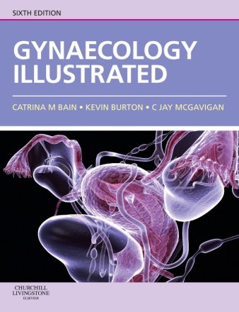 Gynaecology Illustrated. Edition: 6