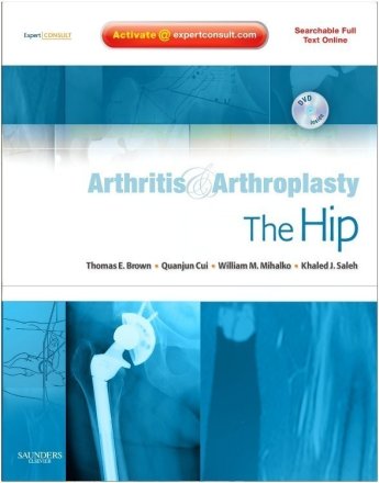 Arthritis and Arthroplasty: The Hip