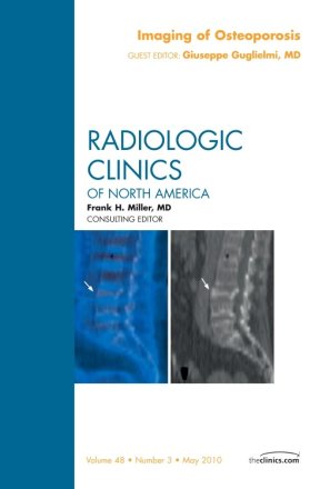Imaging of Osteoporosis, An Issue of Radiologic Clinics of North America