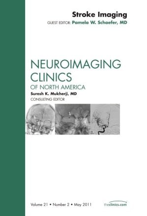 Stroke Imaging, An Issue of Neuroimaging Clinics