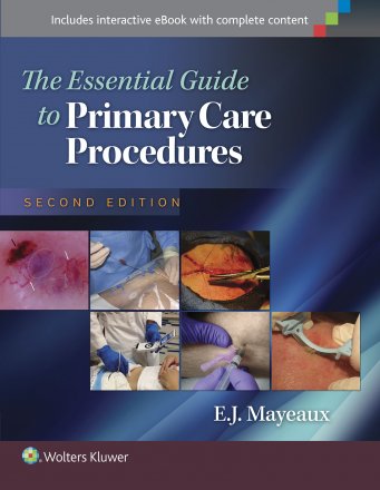 The Essential Guide to Primary Care Procedures. Edition Second