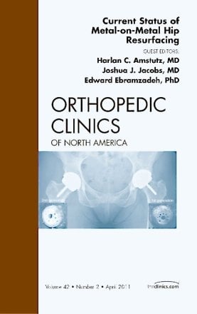 Current Status of Metal-on-Metal Hip Resurfacing, An Issue of Orthopedic Clinics