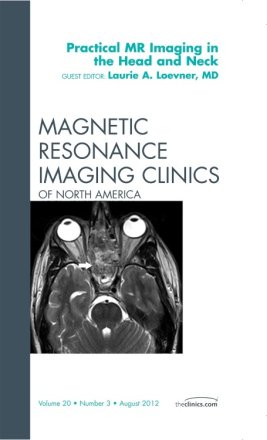 Practical MR Imaging in the Head and Neck, An Issue of Magnetic Resonance Imaging Clinics