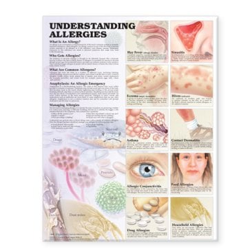 Understanding Allergies Anatomical Chart. Edition Second