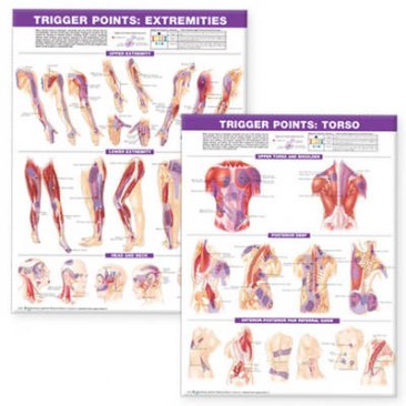 Trigger Point Chart Set 2nd Edition: Torso and Extremities - Laminated ISBN 9780781773072