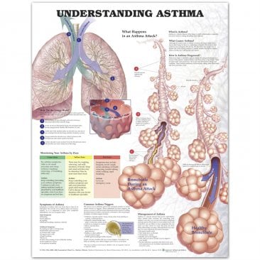 Understanding Asthma Anatomical Chart 2nd Edition - Laminated Anatomical Chart Company ISBN 9781587799389