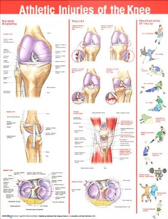Athletic Injuries of the Knee Anatomical Chart