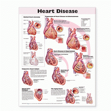 Heart Disease Anatomical Chart. Edition Second