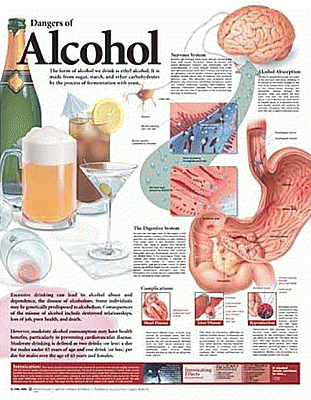 Dangers of Alcohol Anatomical Chart. Edition Second
