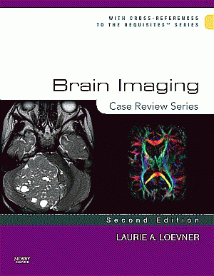 Brain Imaging: Case Review Series. Edition: 2