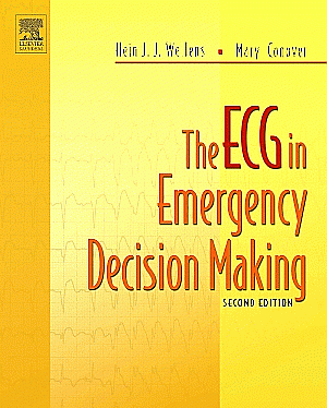 The ECG in Emergency Decision Making. Edition: 2