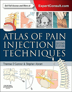 Atlas of Pain Injection Techniques. Edition: 2