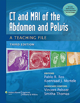 CT & MRI of the Abdomen and Pelvis. Edition Third