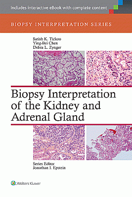 Biopsy Interpretation of the Kidney & Adrenal Gland. Edition First