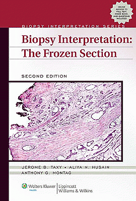 Biopsy Interpretation: The Frozen Section, 2nd Edition