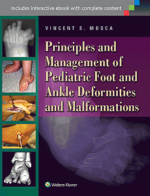 Principles and Management of Pediatric Foot and Ankle Deformities and Malformations. Edition First