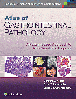 Atlas of Gastrointestinal Pathology. Edition First