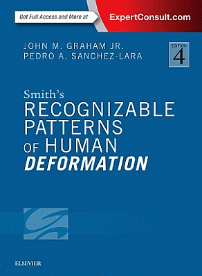 Smith's Recognizable Patterns of Human Deformation. Edition: 4