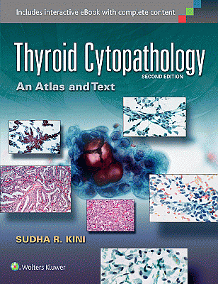 Thyroid Cytopathology. Edition Second