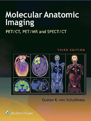 Molecular Anatomic Imaging. Edition Third