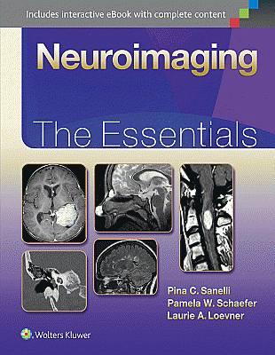 Neuroimaging: The Essentials. Edition First