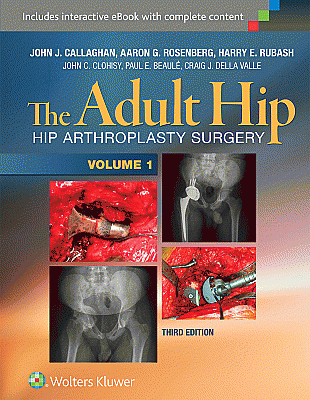 The Adult Hip (Two Volume Set). Edition Third
