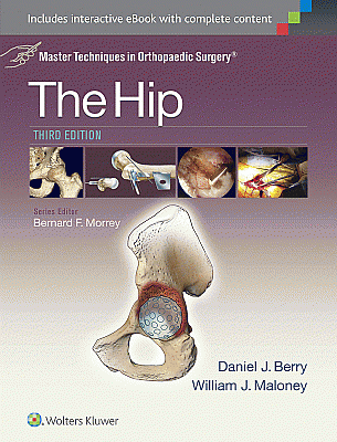 Master Techniques in Orthopaedic Surgery: The Hip. Edition Third