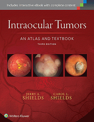 Intraocular Tumors: An Atlas and Textbook. Edition Third