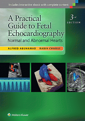 A Practical Guide to Fetal Echocardiography. Edition Third