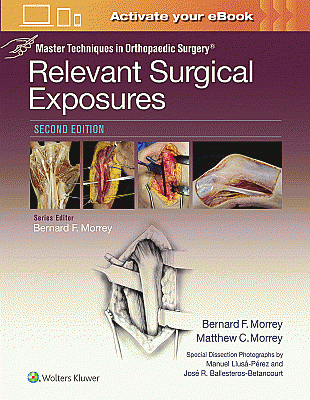 Master Techniques in Orthopaedic Surgery: Relevant Surgical Exposures. Edition Second