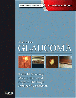 Glaucoma. Edition: 2