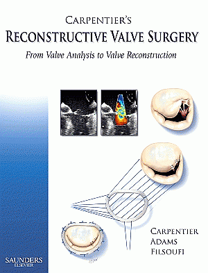 Carpentier's Reconstructive Valve Surgery