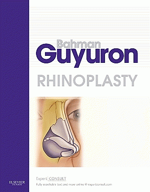 Rhinoplasty