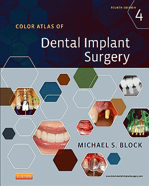 Color Atlas of Dental Implant Surgery. Edition: 4