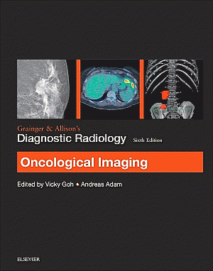 Grainger & Allison's Diagnostic Radiology: Oncological Imaging. Edition: 6