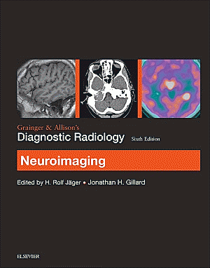 Grainger & Allison's Diagnostic Radiology: Neuroimaging. Edition: 6