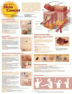 Understanding Skin Cancer Anatomical Chart. Edition Second