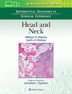 Differential Diagnoses in Surgical Pathology: Head and Neck. Edition First