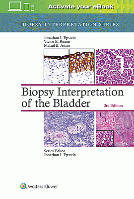 Biopsy Interpretation of the Bladder. Edition Third