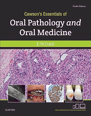 Cawson's Essentials of Oral Pathology and Oral Medicine. Edition: 9