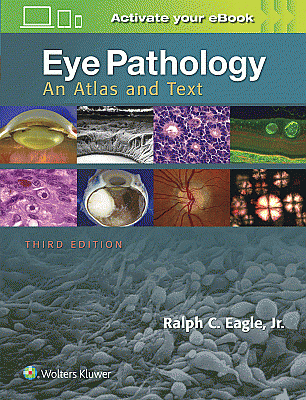 Eye Pathology. Edition Third