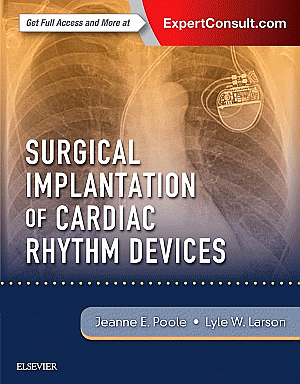 Surgical Implantation of Cardiac Rhythm Devices