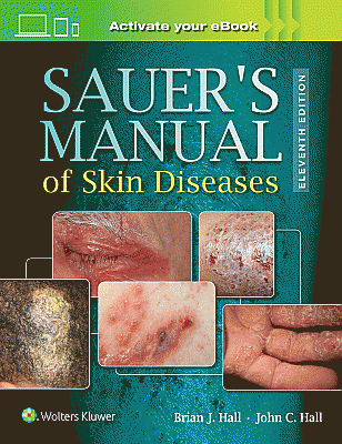 Sauer's Manual of Skin Diseases. Edition Eleventh