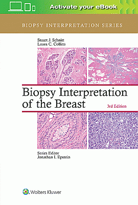 Biopsy Interpretation of the Breast. Edition Third