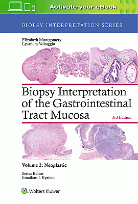 Biopsy Interpretation of the Gastrointestinal Tract Mucosa: Volume 2: Neoplastic. Edition Third