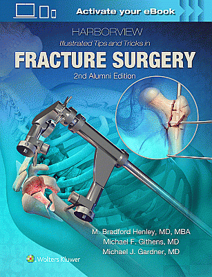 Harborview Illustrated Tips and Tricks in Fracture Surgery. Edition Second