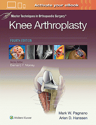 Master Techniques in Orthopedic Surgery: Knee Arthroplasty. Edition Fourth