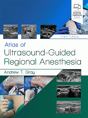Atlas of Ultrasound-Guided Regional Anesthesia. Edition: 3