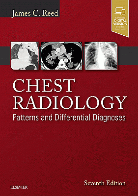 Chest Radiology. Edition: 7